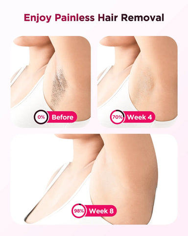 IPL Flash Laser Hair Removal Device